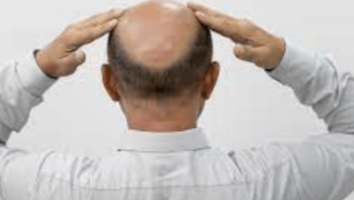 wellhealthorganic.com:ayurvedic-treatment-of-hair-problem