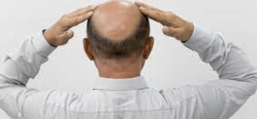 wellhealthorganic.com:ayurvedic-treatment-of-hair-problem