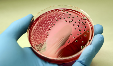 Salmonella Infection: Causes, Symptoms, Treatment