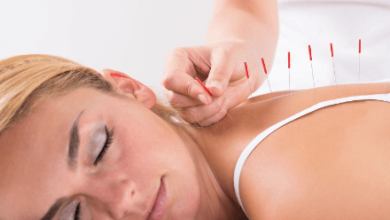 Acupuncture Services