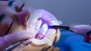 Invisalign vs. Braces: Benefits of Clear Aligners for Adults