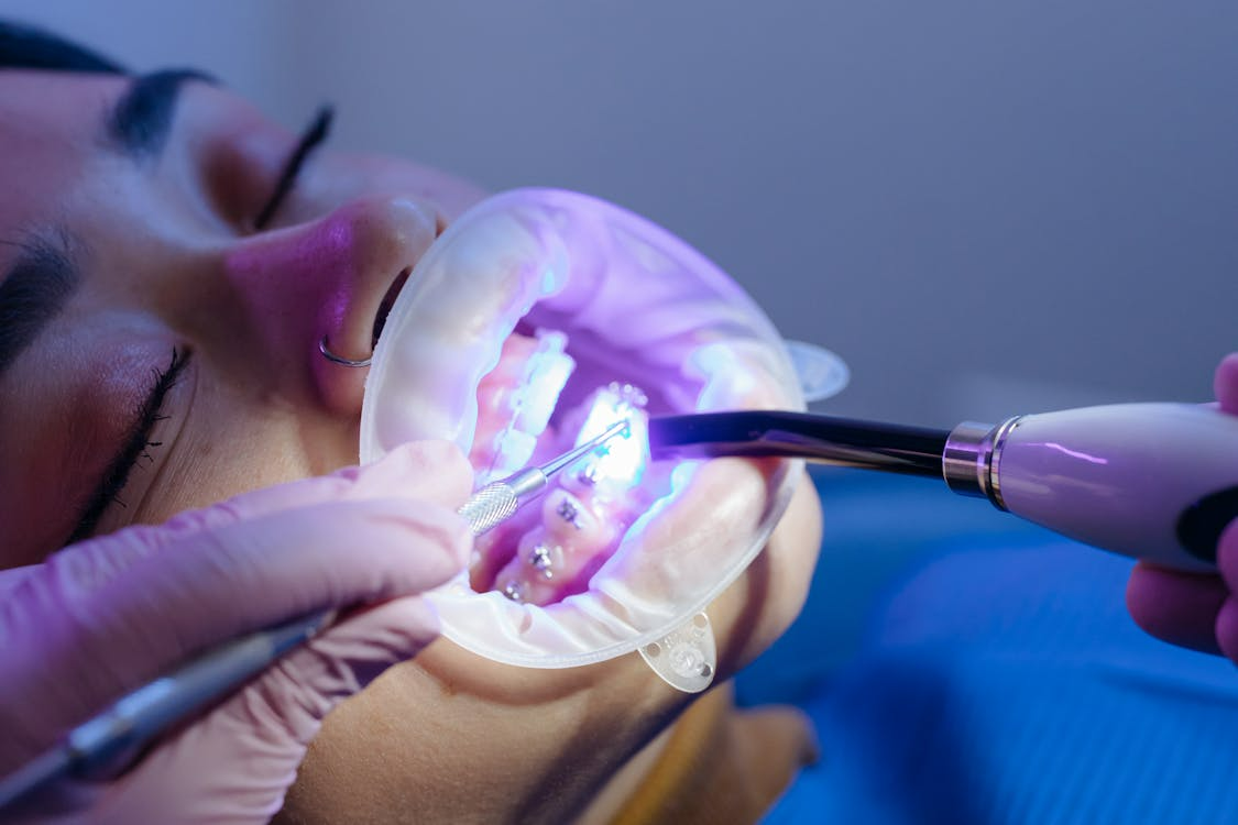 Invisalign vs. Braces: Benefits of Clear Aligners for Adults